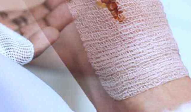 Wound Care Types